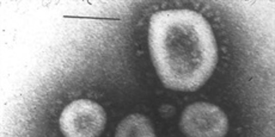 virus corona bisa bertahan dalam suhu 60 derajat celcius selama 1 jam