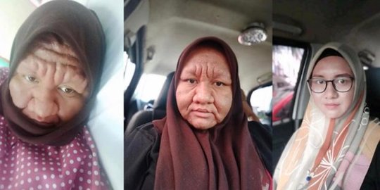 Hamil Anak Ketiga, Wajah Wanita Ini Berubah Seperti Nenek-nenek