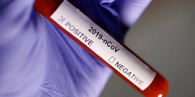 Tidak Pernah Keluar Rumah, Istri Kepala Dinas di Bondowoso Positif Corona