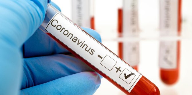4 WN India di Yogyakarta Dinyatakan Positif Virus Corona