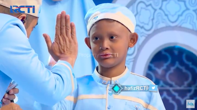 kisah inspirasi habib hafiz cilik yang alami kelainan fisik kilit tanpa pori pori