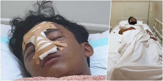 Tegur Kakak Beradik Agar Pakai Masker Saat Nongkrong, Warga Penjaringan Dikeroyok