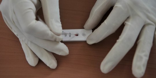 Pemprov Jabar Maksimalkan 40 Ribu Stok PCR Selama PSBB