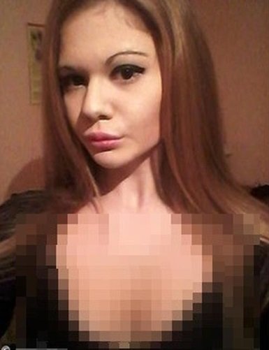 wanita berbibir paling besar pernah injeksi 20 kali