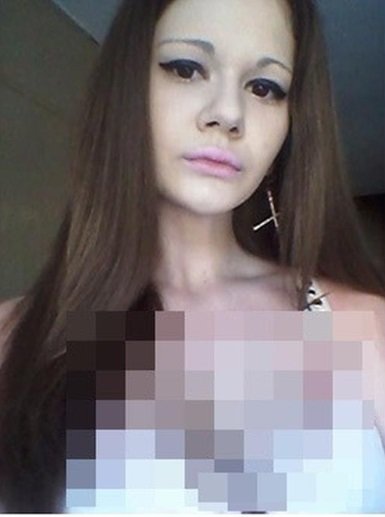 wanita berbibir paling besar pernah injeksi 20 kali