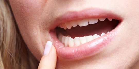 Kesehatan Gigi dan Mulut Jadi Kunci Jaga Kekebalan Tubuh