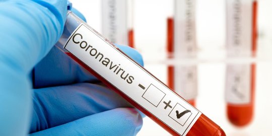 Jubir Corona Riau: Covid-19 Tidak Bisa Diatasi dengan Herd Immunity