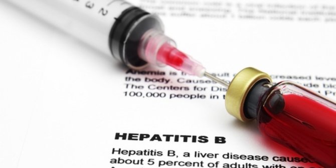 7 Gejala Hepatitis B Yang Mudah Dikenali, Ketahui Penyebab Dan Cara ...