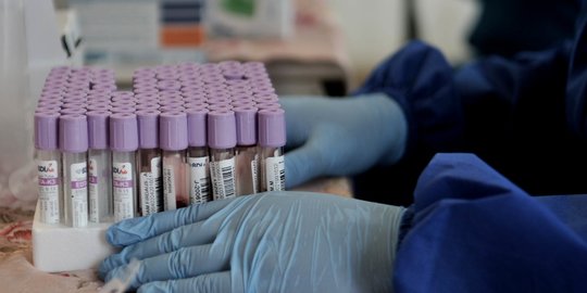 Takut Di-rapid Test, Sejumlah Warga Masigit Serang Tinggalkan Rumah