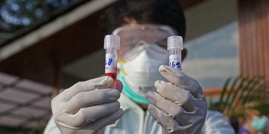 Pemprov Jabar Sebut Jumlah Pengetesan Metode PCR Sudah Lampaui Standar WHO