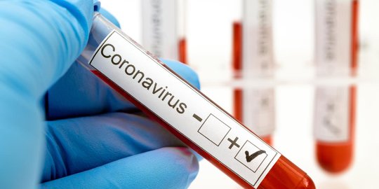 CEK FAKTA: Benarkah Kandungan Betadine Efektif Membunuh Virus Covid-19? Ini Faktanya