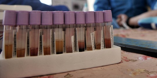 Gubernur Sulsel Serahkan 4.000 Rapid Test ke Unhas