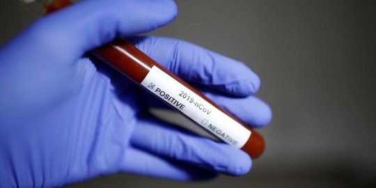 6 Tenaga Medis Positif Virus Corona di Indragiri Hilir