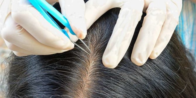 6 Penyebab Rambut Beruban, Begini Cara Mencegahnya