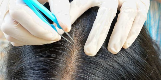 8 Cara Mencegah Rambut  Beruban secara Alami  Tanpa  Bahan  