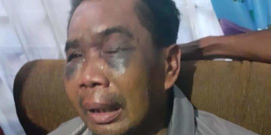 Saat Jokowi Minta Polri Berbenah Muncul Kasus Penyiksaan Saksi