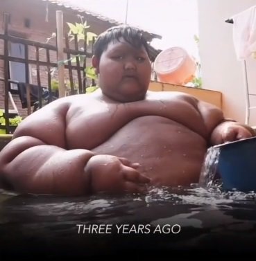 potret terbaru arya 039bocah obesitas039