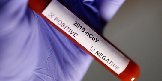 1 Karyawan TVRI Dinyatakan Positif Corona Berdasarkan Tes PCR, 5 Negatif