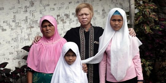Dilarang Didatangi pada Jumat dan Sabtu, Ini 7 Fakta Kampung 'Albino' di Garut