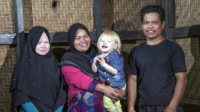 kampung albino