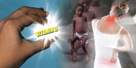 6 Dampak Kekurangan Vitamin D bagi Tubuh, Kenali Sejak Dini