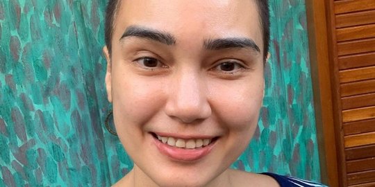 Selain Feby Febiola, 4 Artis Ini Juga Sempat Jalani Kemoterapi