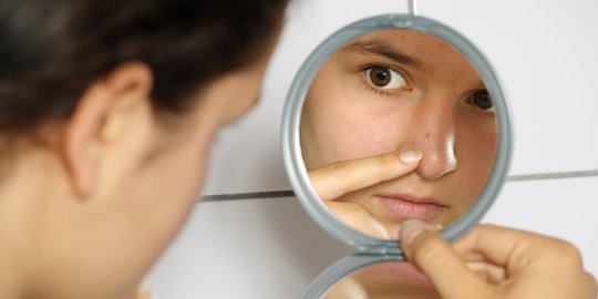 9 Cara Menghilangkan Bekas Jerawat dan Flek Hitam di Wajah, Ampuh dan Cepat