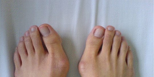 7 penyebab kaki kesemutan, mulai dari sepatu hingga masalah saraf