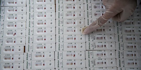 Hari ini hanya 15 Ribu Spesimen yang Diperiksa, Setengah dari Target Jokowi