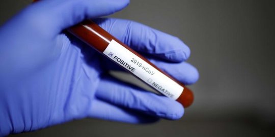 WNA Asal Swiss Tertular Virus Corona di Riau