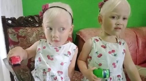 kembar albino asal wonogiri