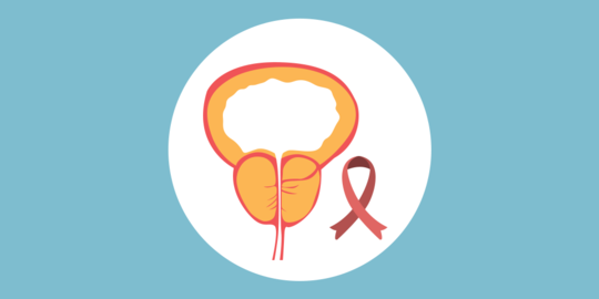 5 Cara Mencegah Kanker Prostat Secara Alami, Mudah Dilakukan