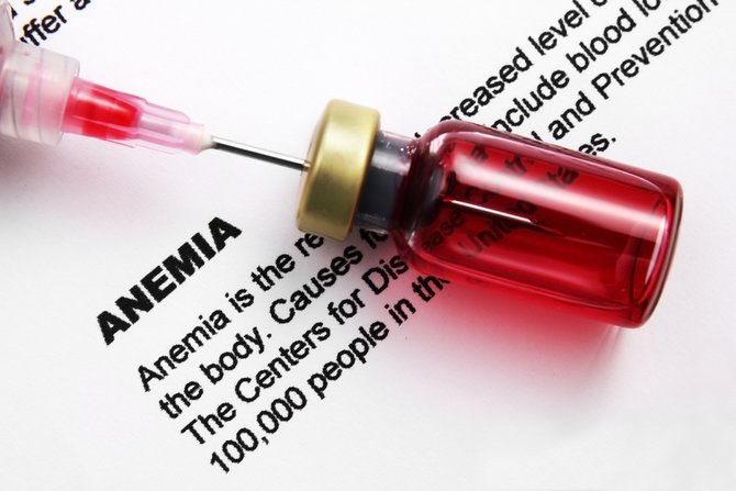 anemia illustration