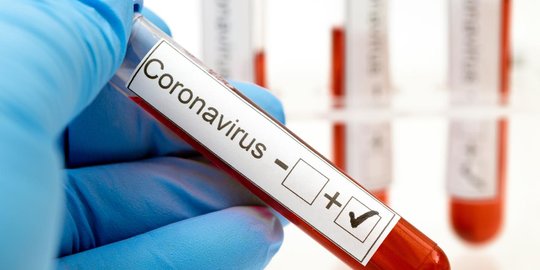 Rapid Test Massal, 5 Pegawai Pemkot Cilegon Reaktif Covid-19