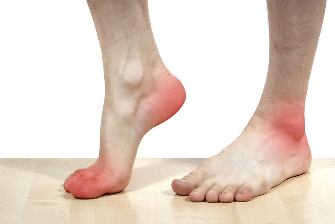 ilustrasi kaki sakit