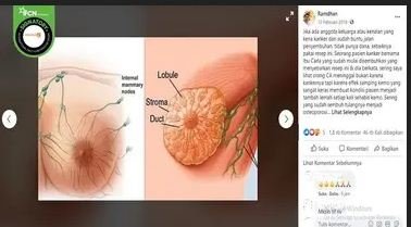 tidak benar kunyit bisa sembuhkan kanker payudara