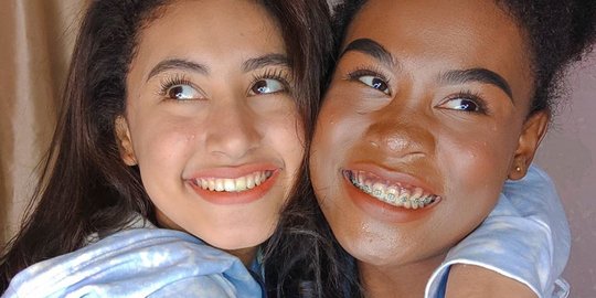 Potret Cantik Afifah dan Sylla, Kakak Beradik Kandung Tapi Beda Banget