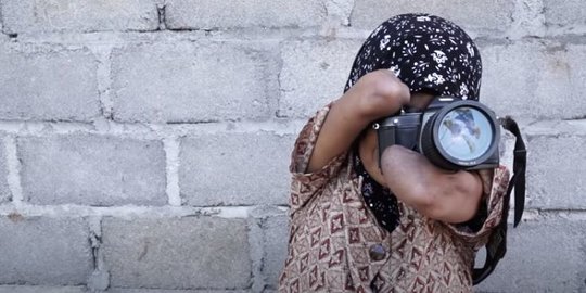 Kisah Inspiratif Difabel yang Kehilangan Dua Tangan, Kini Jadi Fotografer Profesional