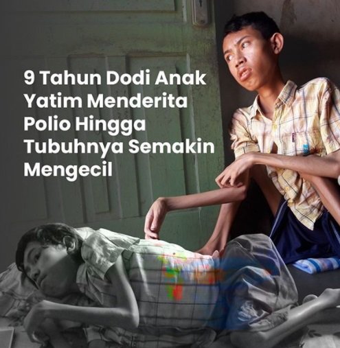 kisah bocah badan tinggal tulang idap polio selama 9 tahun