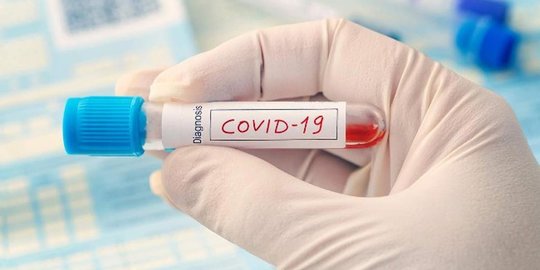Warga Diminta Waspadai Potensi Klaster Covid-19 dalam Keluarga, Berikut Faktanya