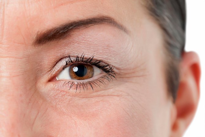 Penyebab Glaukoma Mata Memicu Kebutaan
