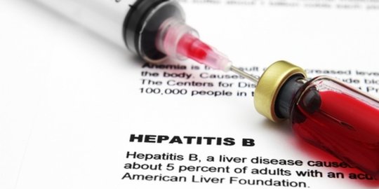 Penyebab Hepatitis B yang Harus Diwaspadai, Kenali Gejala dan Cara Mengatasinya