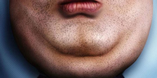 5 Olahraga Sederhana untuk Menghilangkan Double Chin dan Gelambir Lemak di Leher