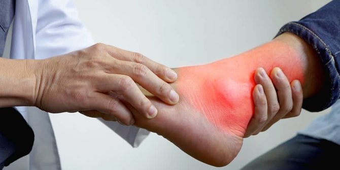 Keterangan Seputar Kadar Asam Urat Normal Alodokter