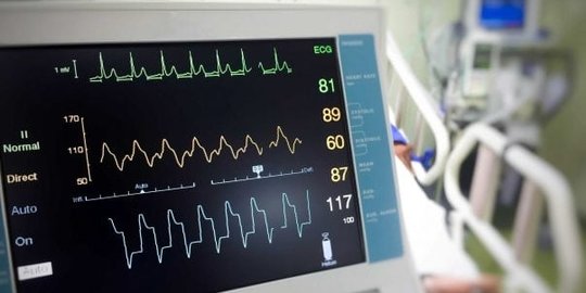 Cara Membaca EKG saat Mengecek Kondisi Jantung, Perhatikan Setiap Langkah-langkahnya