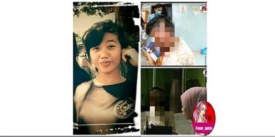 Kisah Pilu Lindha, Perempuan yang Viral Karena Luka Bakar di Wajah dan Tak Dikenali