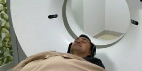 Duh! Anjasmara Jalani Pemeriksaan CT Scan Usai Jatuh dari Sepeda Saat Lawan Jambret