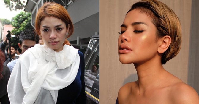 artis indonesia operasi hidung