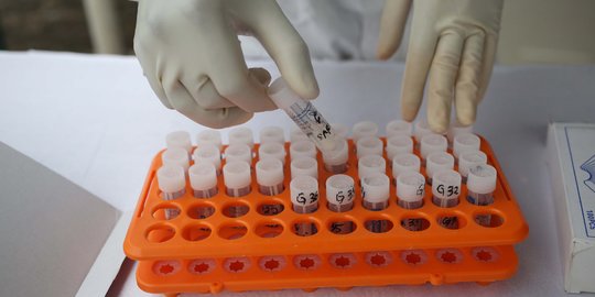 Rutan di Medan Pertimbangkan Penggunaan Tes Swab Antigen