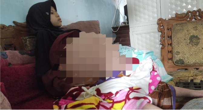 kisah pilu sindi gadis penderita kista ganas yang tinggal di gubuk reyot